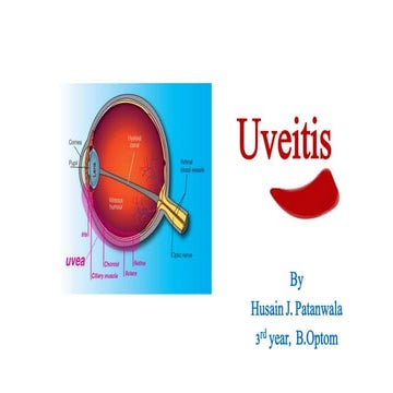 Uveitis