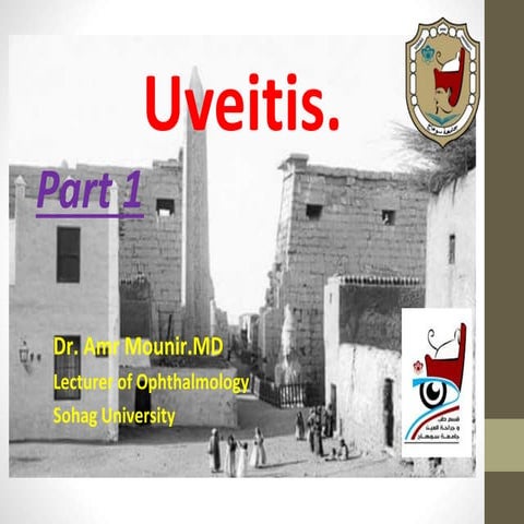 Uveitis
