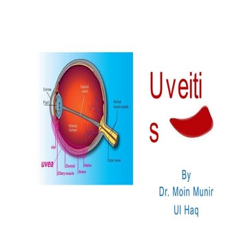uveitis.pptx
