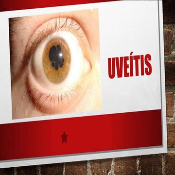 Uveitis | PPTX