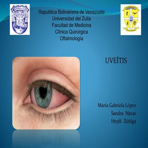 Uveitis | PPTX