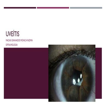 Tabla comparativa uveítis, signos y síntomas, clínica y tratamiento | PDF