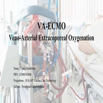 VenoArterila ECMO - 006.pptx