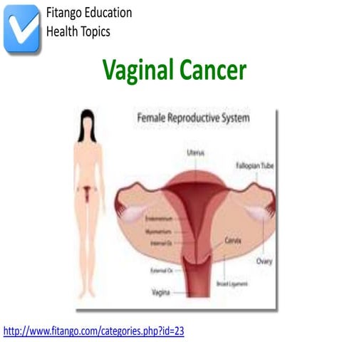 Vaginal Cancer