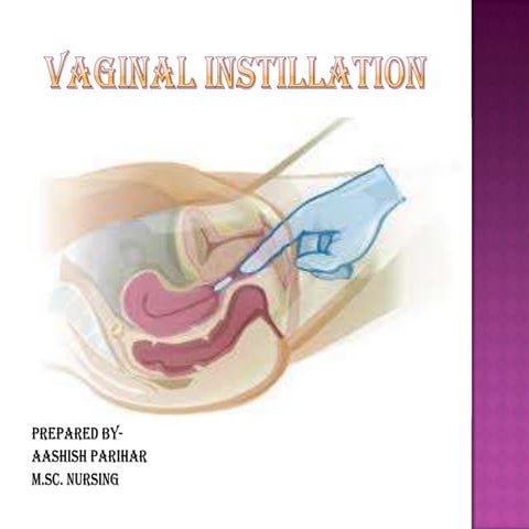 Vaginal instillation