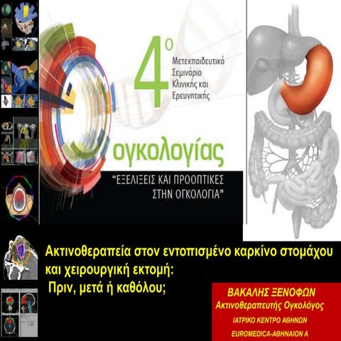 Vakalis - gastric ca radiotherapy