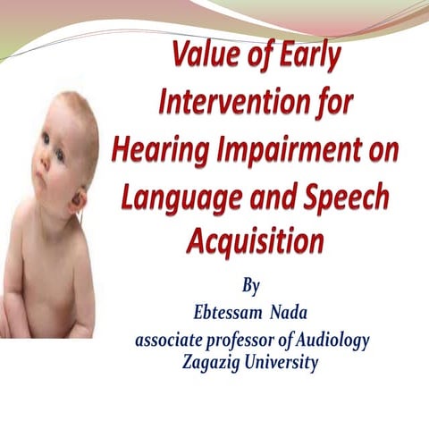 Value of early intervention for hearing impairment on speech and language aqu...