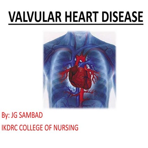 Valvular heart disease