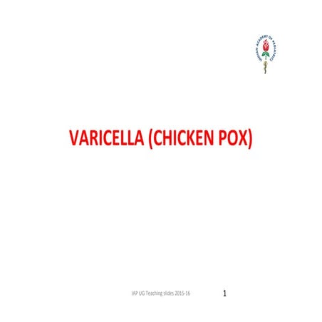 Comprehensive Overview of Varicella (Chicken Pox) and Herpes Zoster | PDF