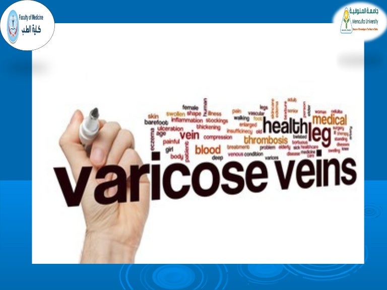 varicoza dupa 30 cu vene varicoase pot arde viaa