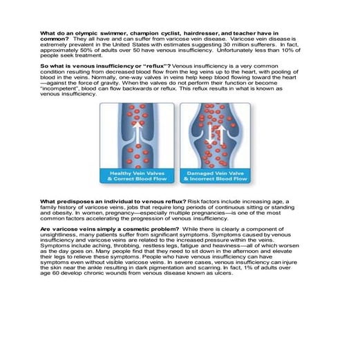 What is varicose vein disease, a primer