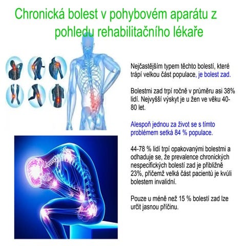 Chronická bolest v pohybovém aparátu z pohledu rehabilitačního lékaře