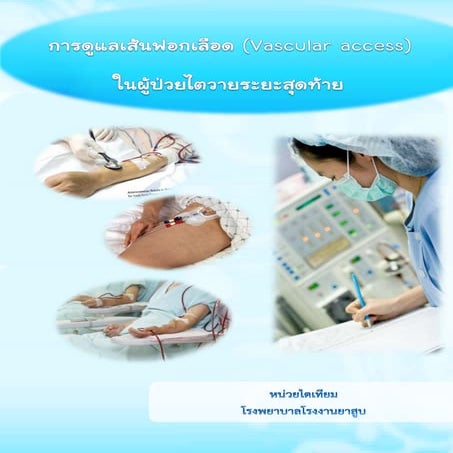 การดูแลเส้นฟอกเลือด (Vascular access) ในผู้ป่วยไตวายระยะสุดท้าย