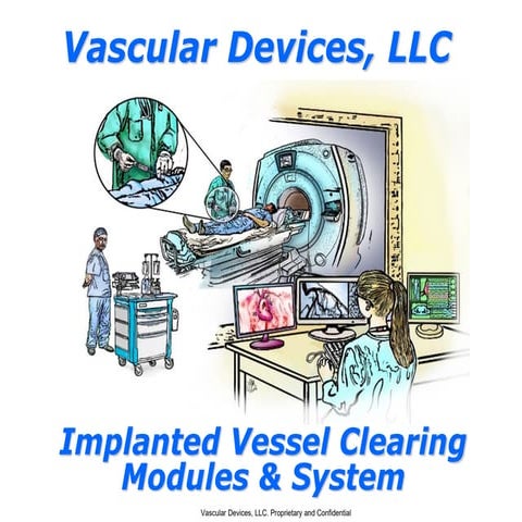 Vascular devices llc_implanted_vessel_clearing_modules_&amp;_system_02-21-2021