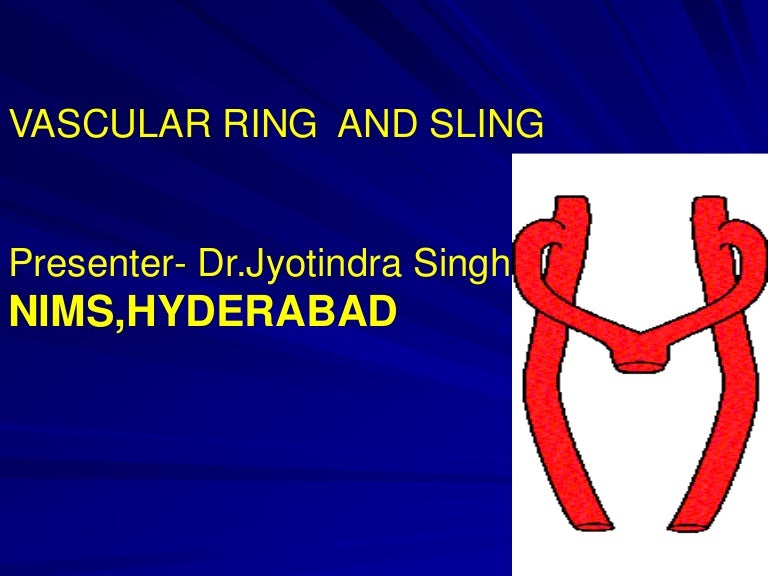 Vascular ring and sling