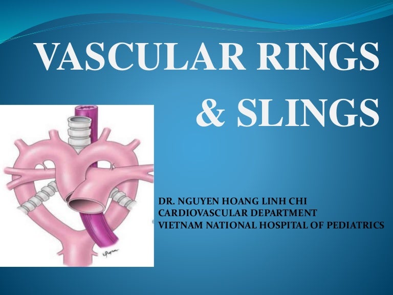 Vascular ring & Sling