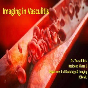 Vasculitis.pptx