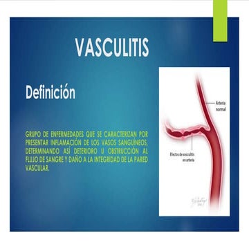 Vasculitis  de pequeños vasos 