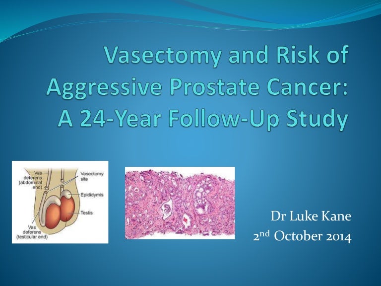 Vasectomy and Risk of Aggressive Prostate Cancer