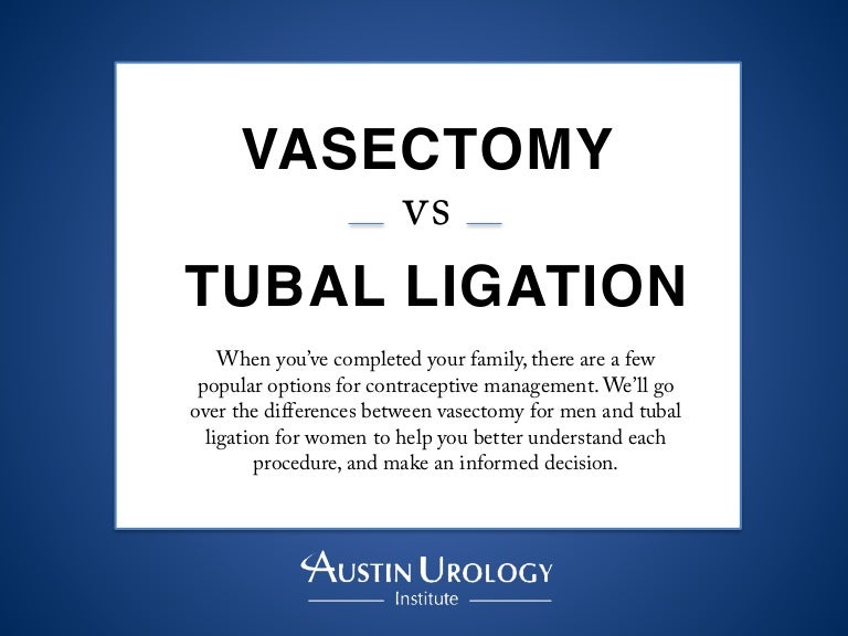 Vasectomy vs. Tubal Ligation