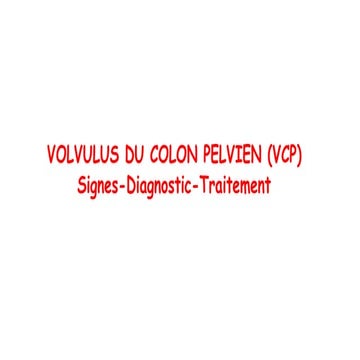 Le volvulus du colon sigmoide: signes, diagnostic et traitemet pptx | PPTX