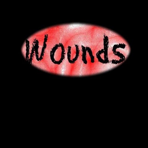 mapeh-9health-on-wounds quarter four grade9 | PPTX