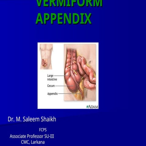Comprehensive Overview of Vermiform Appendix and Acute Appendicitis ...
