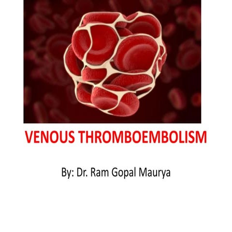 Venous thromboembolism, THROMBOPROPHYLAXIS and management