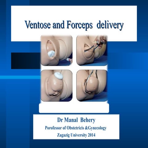 Ventose and forceps delivery for undergraduate