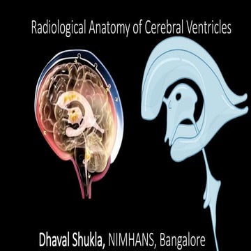 Radiological and Endoscopic VENTRICLE ANATOMY AND LESIONS.pptx