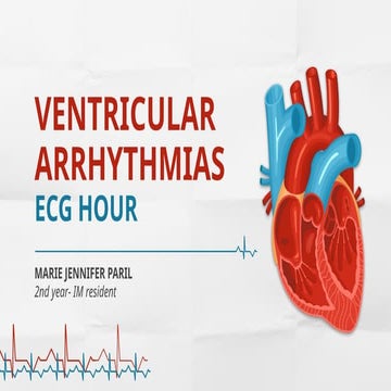 VENTRICULAR ARRHYTHMIAMMMMMMMMMMMMMMMMMM