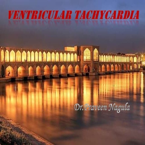 Ventricular tachycardia