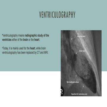Left ventricular angiogram (1) | PPTX