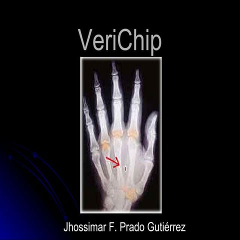 Verichip | PPT