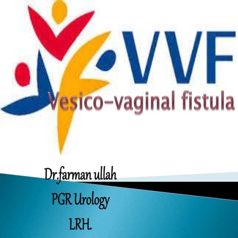 Vesico vaginal fistula