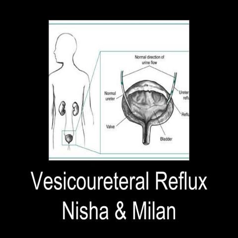 Vesicoureteral reflux period 4