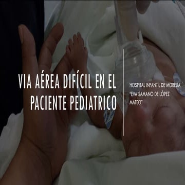ESCALA DE COPUR VIA AEREA DIFICIL PEDIATRICA | PDF