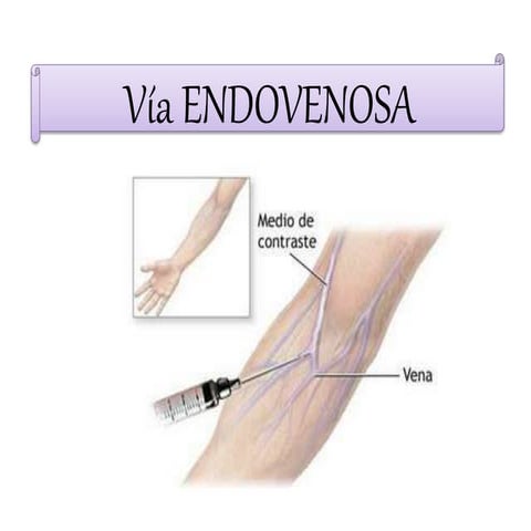 via endovenoso.pptx