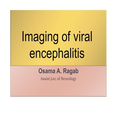viral endasdasdasdasdadqwewqrfrvecephalopathy.pdf