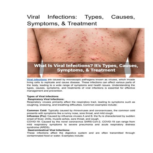 Viral Infections: Types, Causes, Symptoms, & Treatment | PDF
