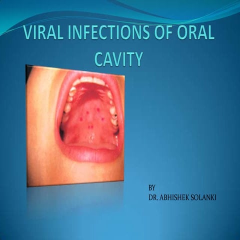Viral infections of oral cavity - Dr. Abhishek Solanki