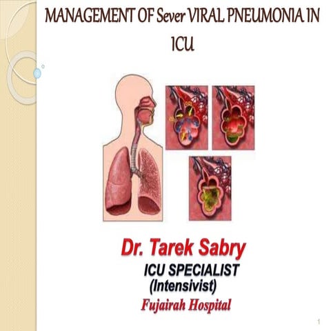 SEVER Viral pneumonia last