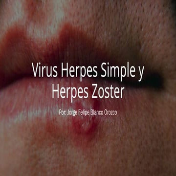 Comprehensive Overview of Herpes Simplex and Herpes Zoster Viruses ...
