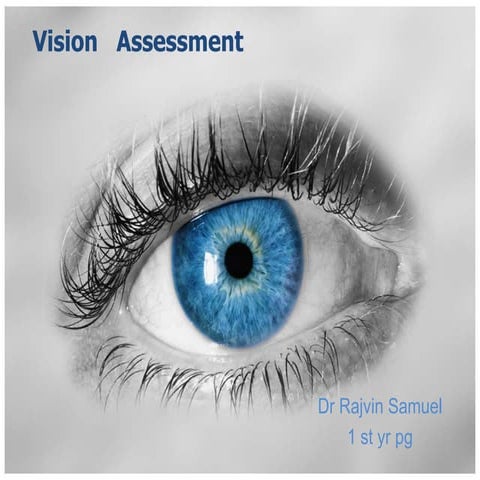 Vision   assessment