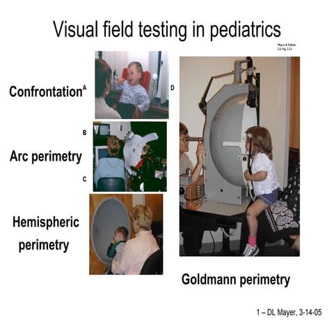 Visual field testing in pediatrics
