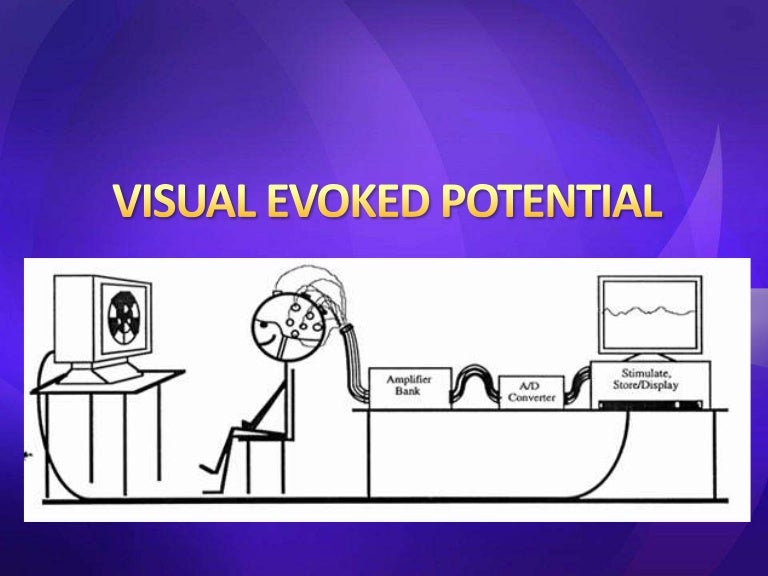 Visual evoked potential