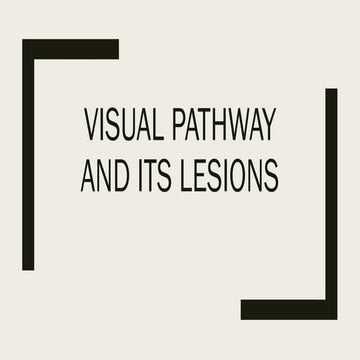 OPTIC NERVE & VISUAL PATHWAY | PPTX