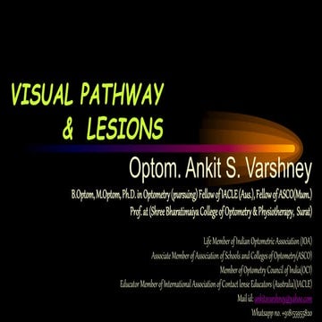 Visual pathway ankit varshney.