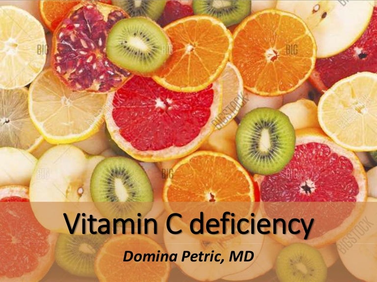 Vitamin C deficiency