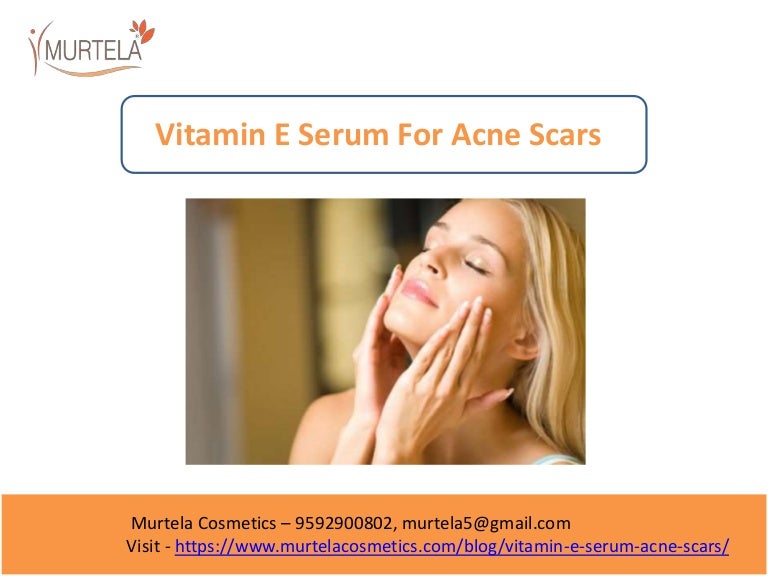 Vitamin E serums for acne scars